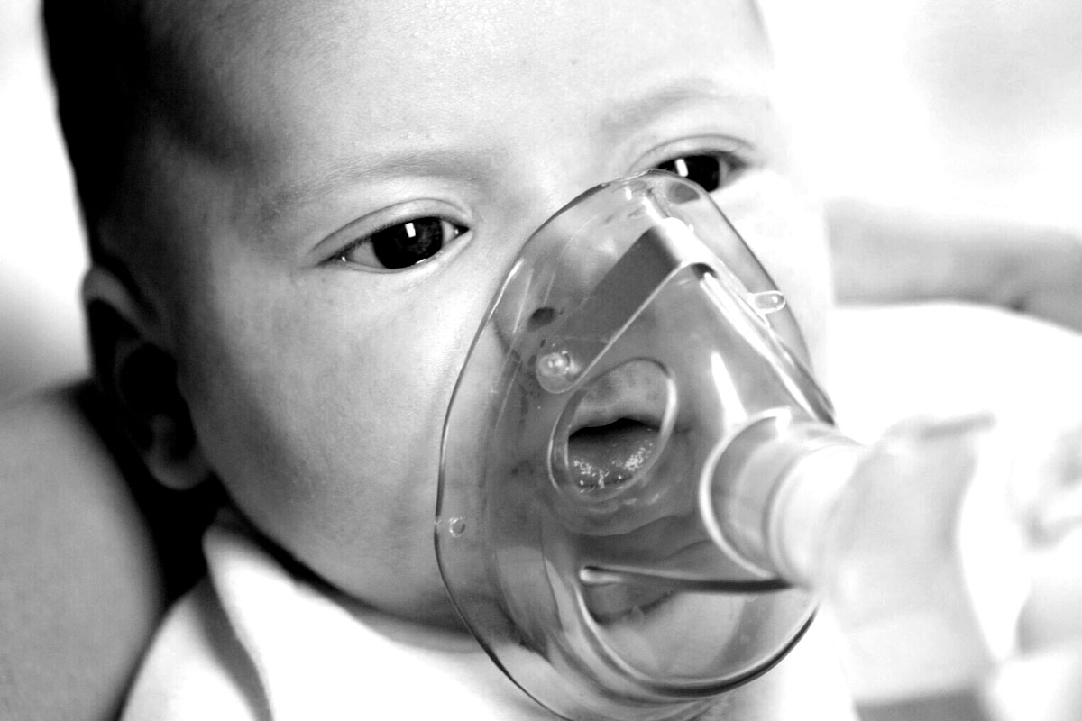 El virus respiratorio sincitial es la primera causa de bronquiolitis y hospitalización en lactantes. 